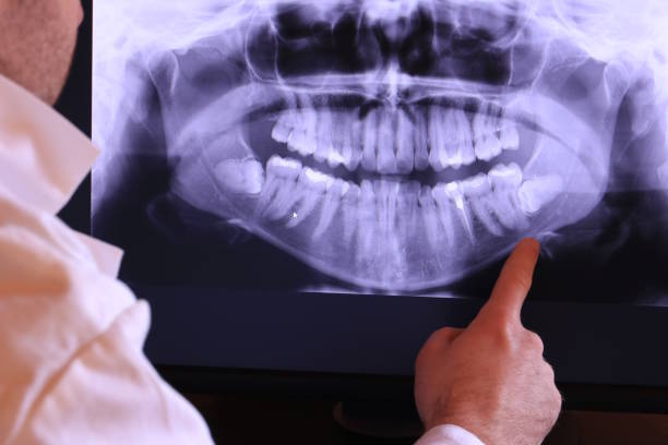 Best Cracked Tooth Emergency Dentist  in Bermuda Run, NC